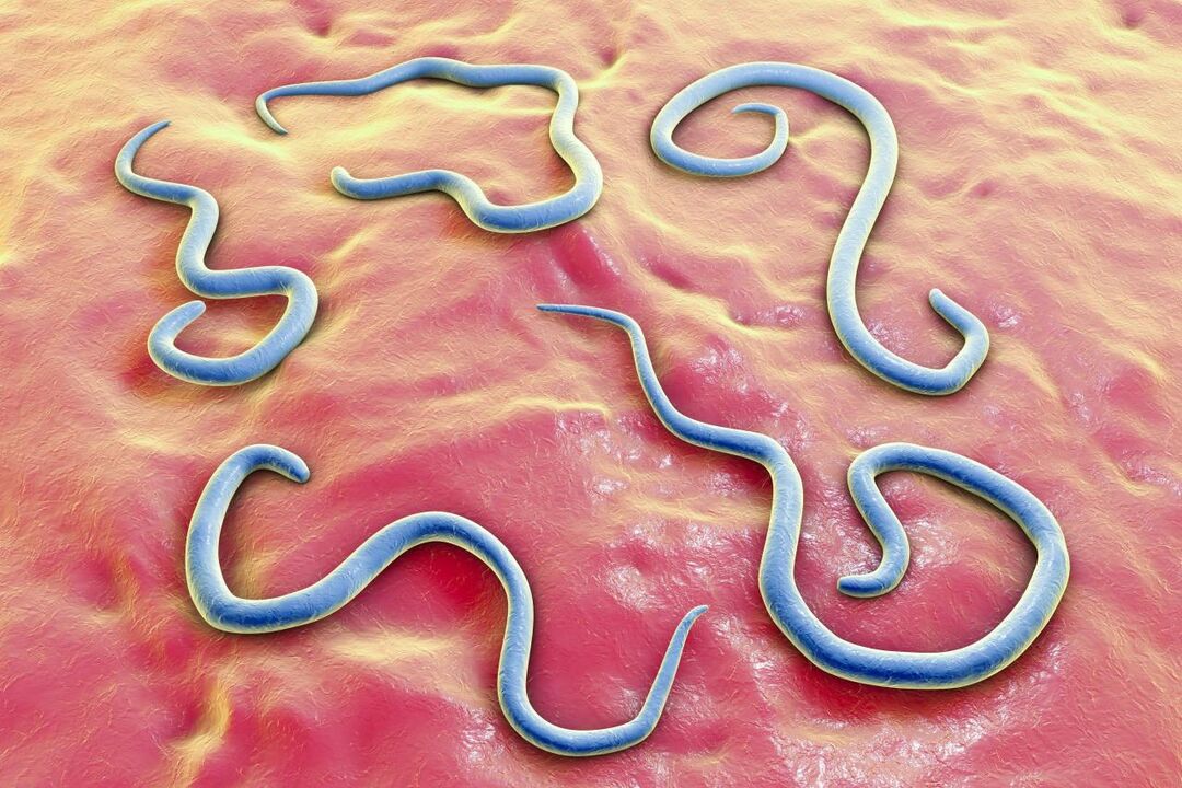 cacing parasit dalam tubuh manusia human