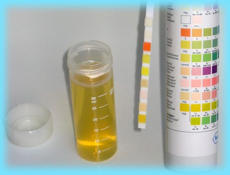 Analisis urin